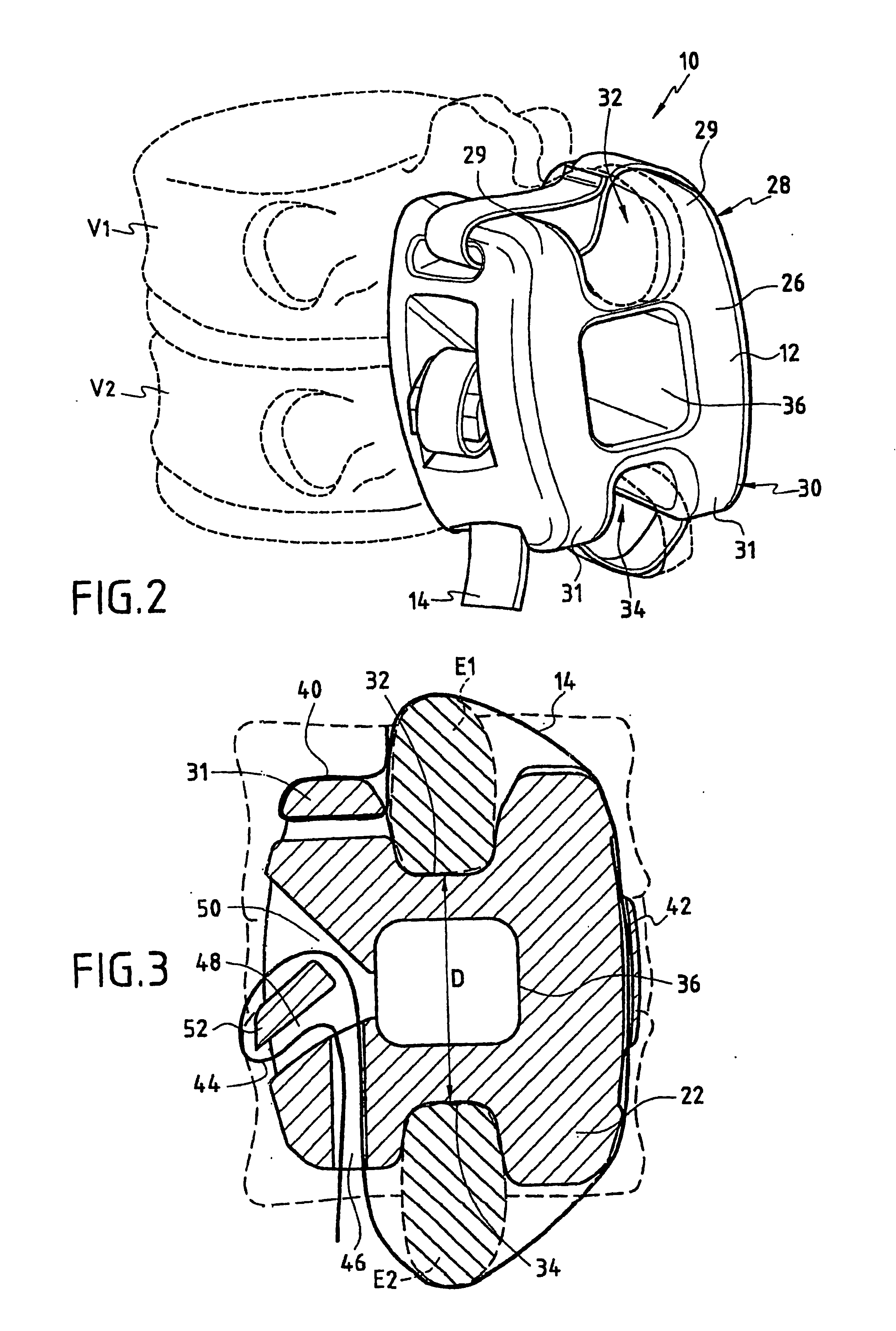 Unit for treatment of the degeneration of an intervertebral disc