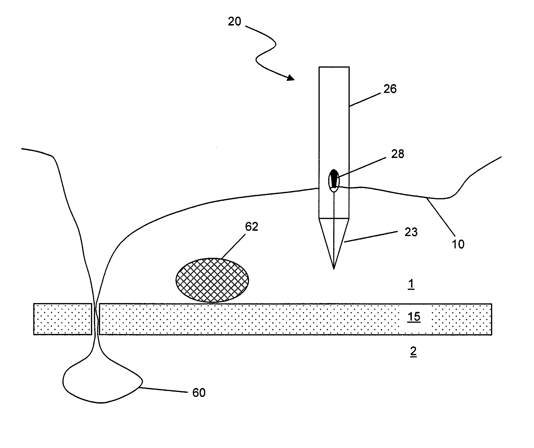 Suture passer with suture capturing articulating jaw at distal end for suturing in arthroscopic surgery