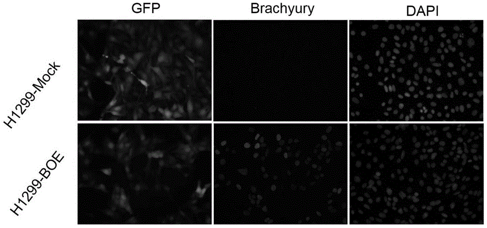 Application of Hsa-miR-3200-5P in preparation of reagents or kits for early screening or diagnosis of Brachyury positive tumours