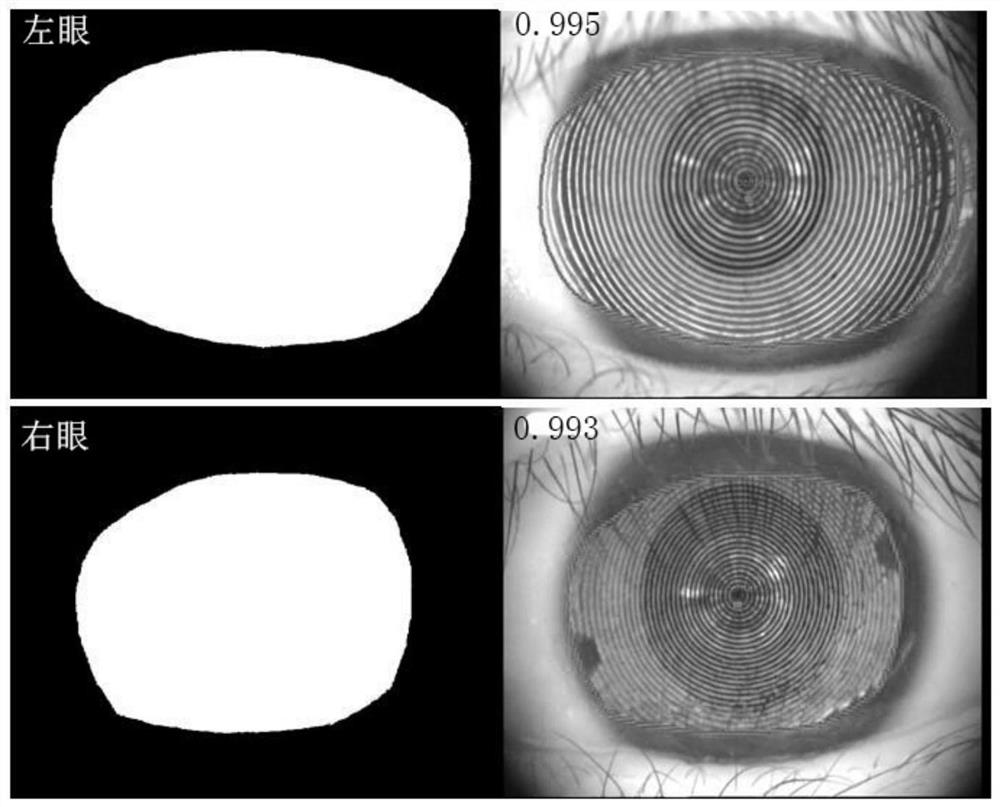 Corneal reflection image screening method and device, intelligent terminal and storage medium