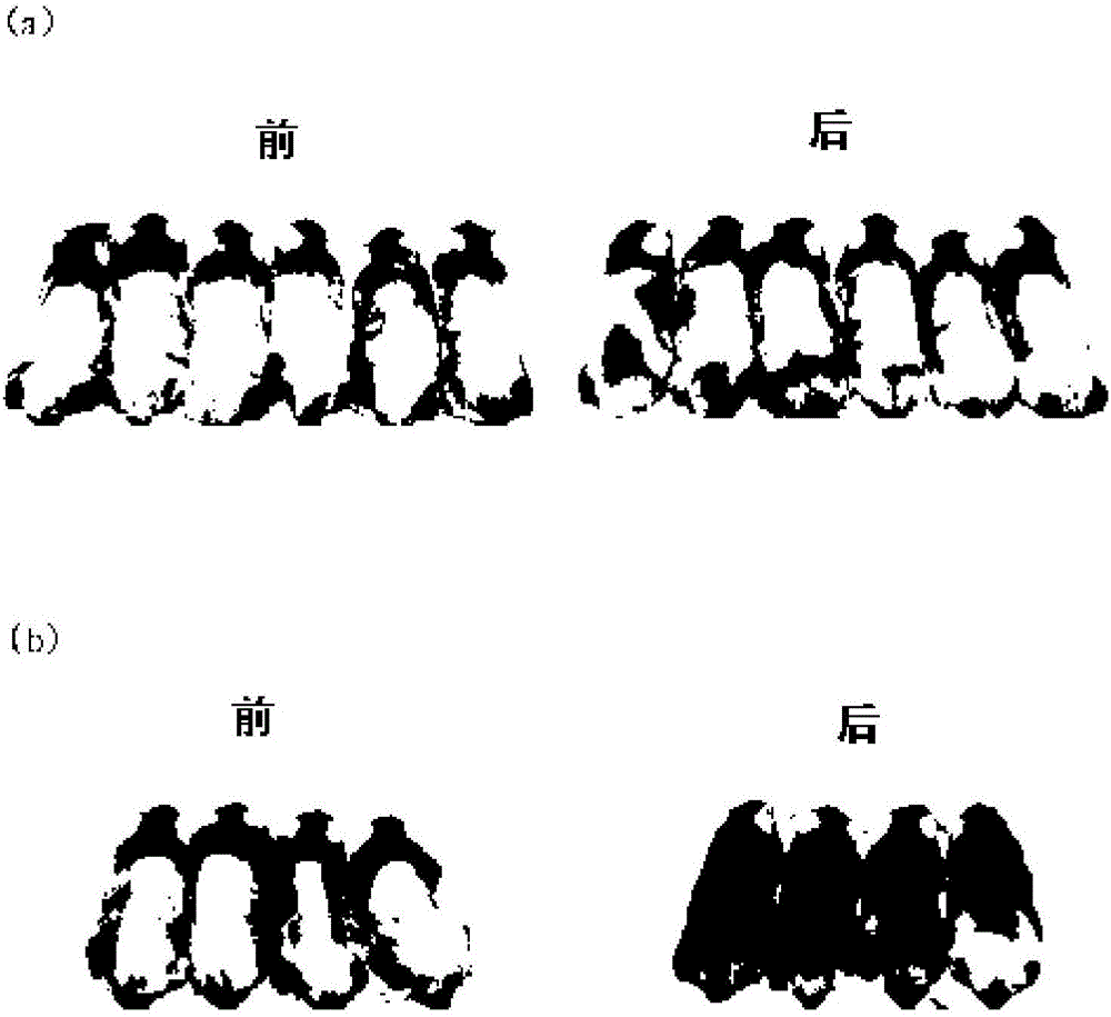 Composition for promoting hair growth or preventing hair loss