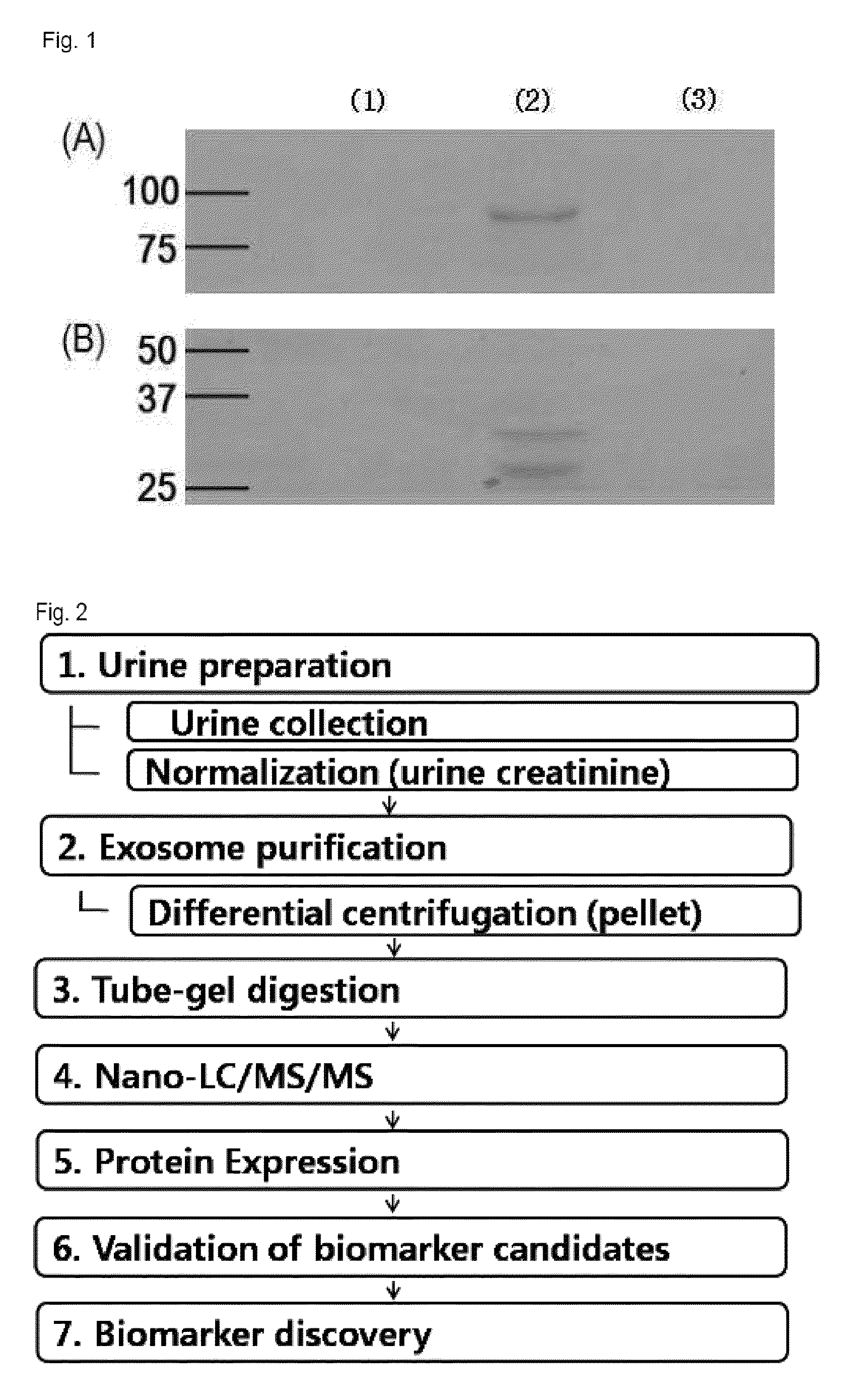 Method for diagnosing immunoglobulin A nephropathy and TGBM nephropathy