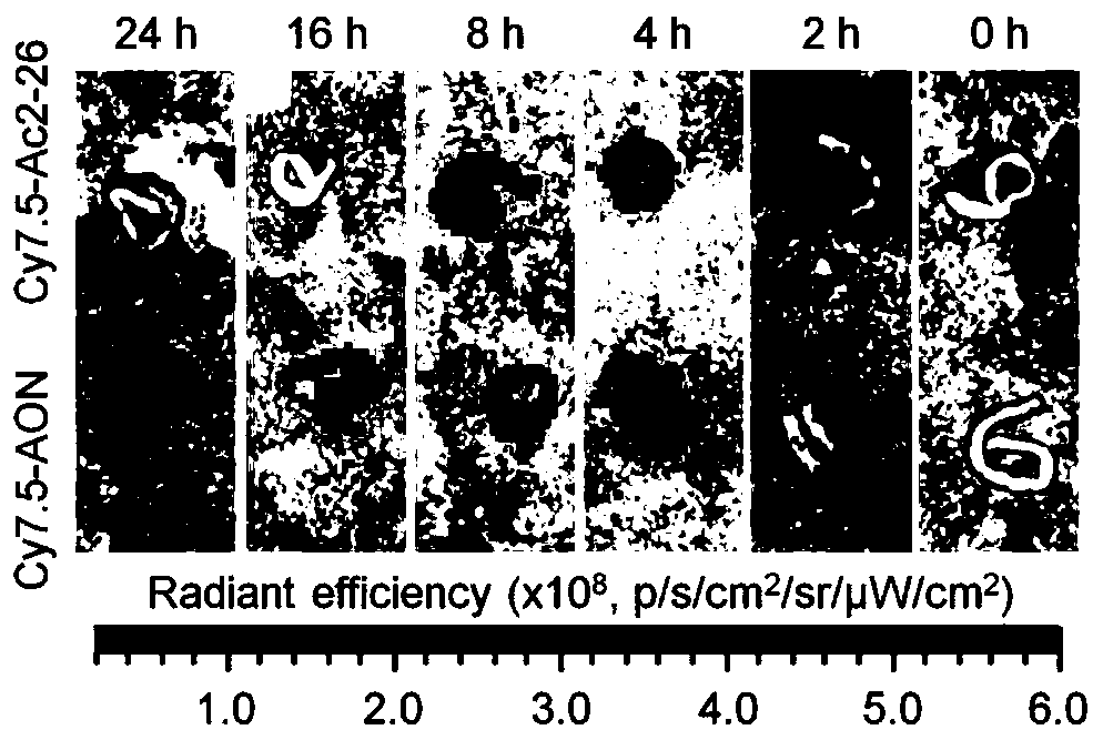 Anti-inflammatory polypeptide nano drug and preparation method thereof