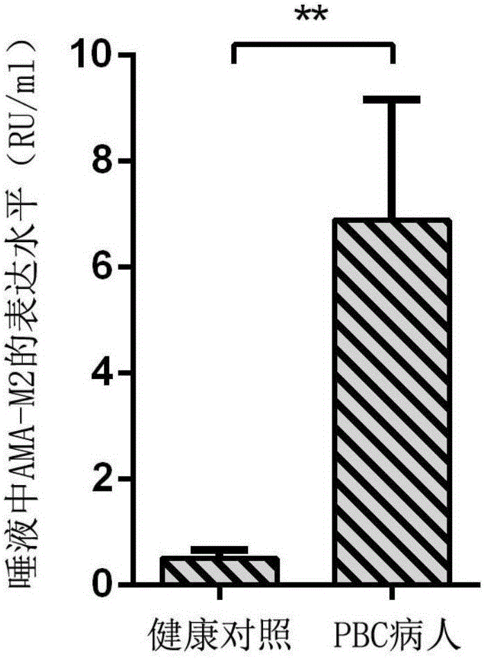 Saliva-anti-mitochondrial-antibody-M2-type enzyme-linked immunity detection kit