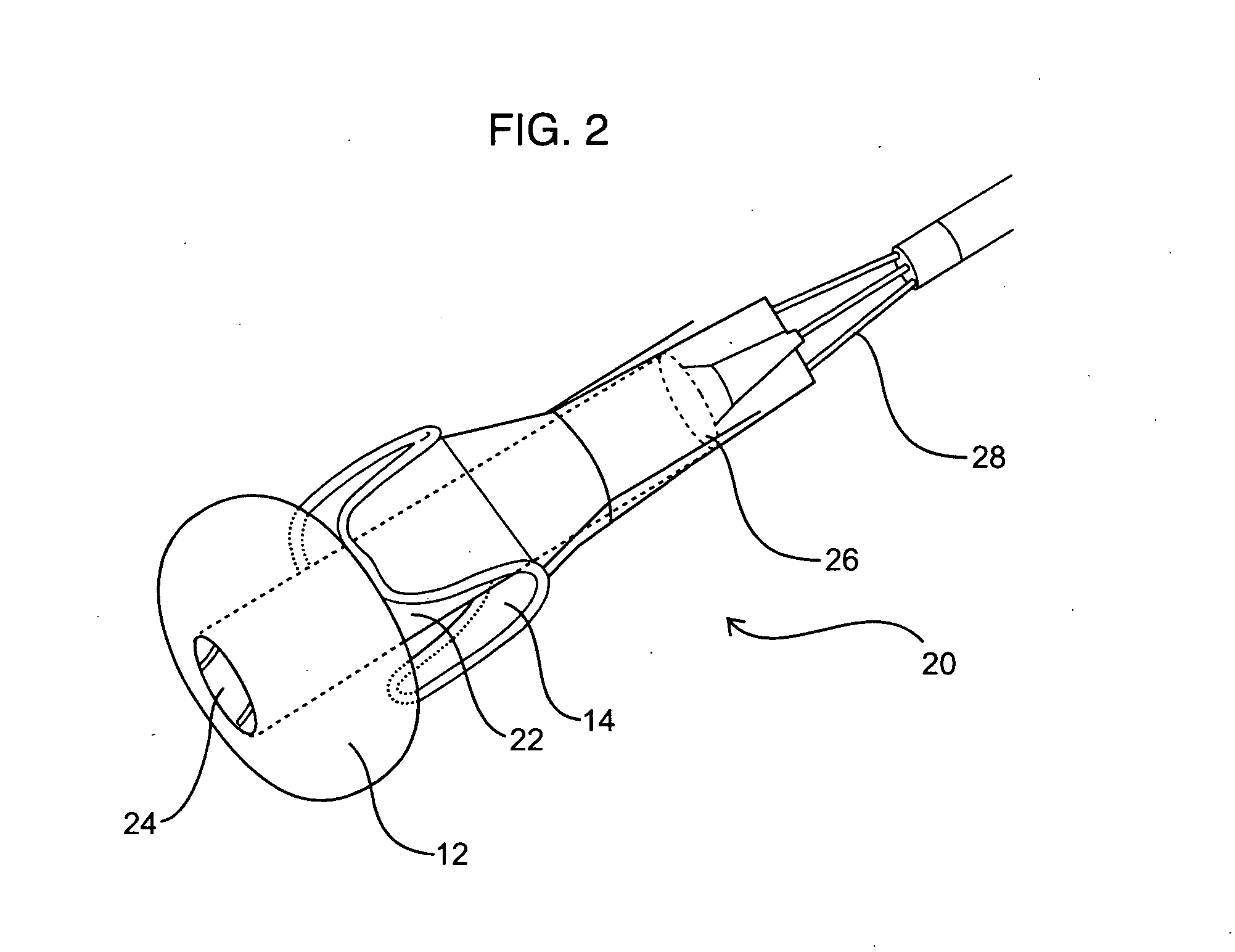 Devices and methods for percutaneously treating aortic valve stenosis