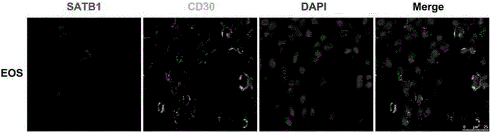 Application of satb1 in the treatment of cutaneous T-cell lymphoma