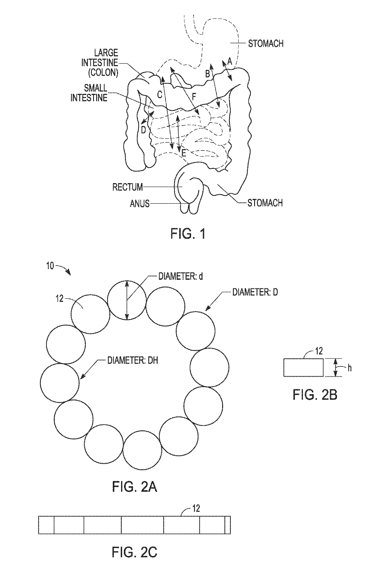 Magnetic anastomosis devices