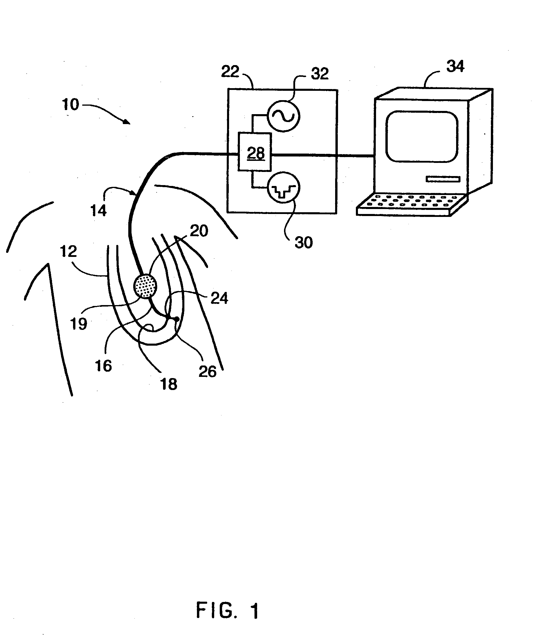 Software for mapping potential distribution of a heart chamber