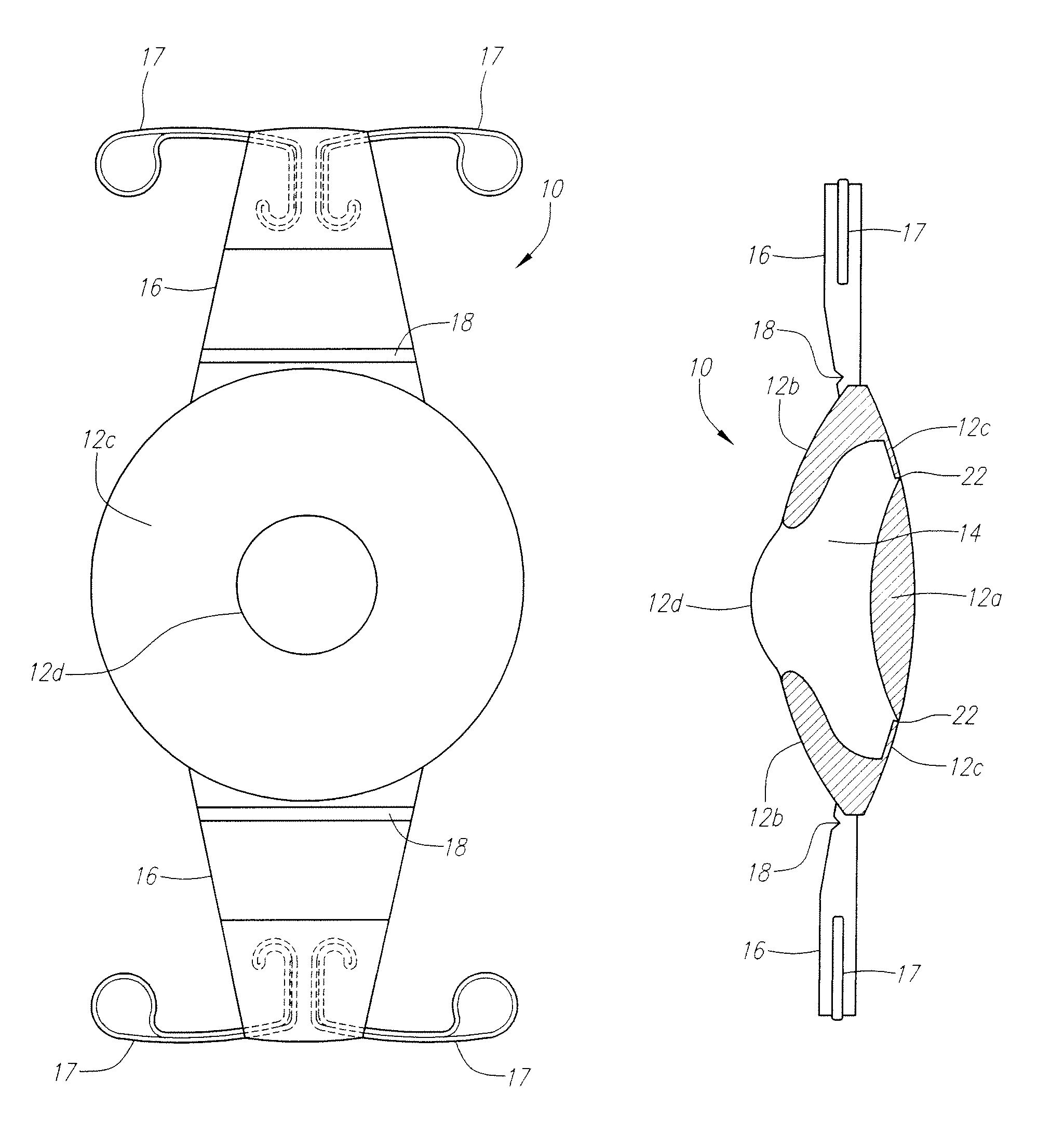 Hydrolic accommodating intraocular lens