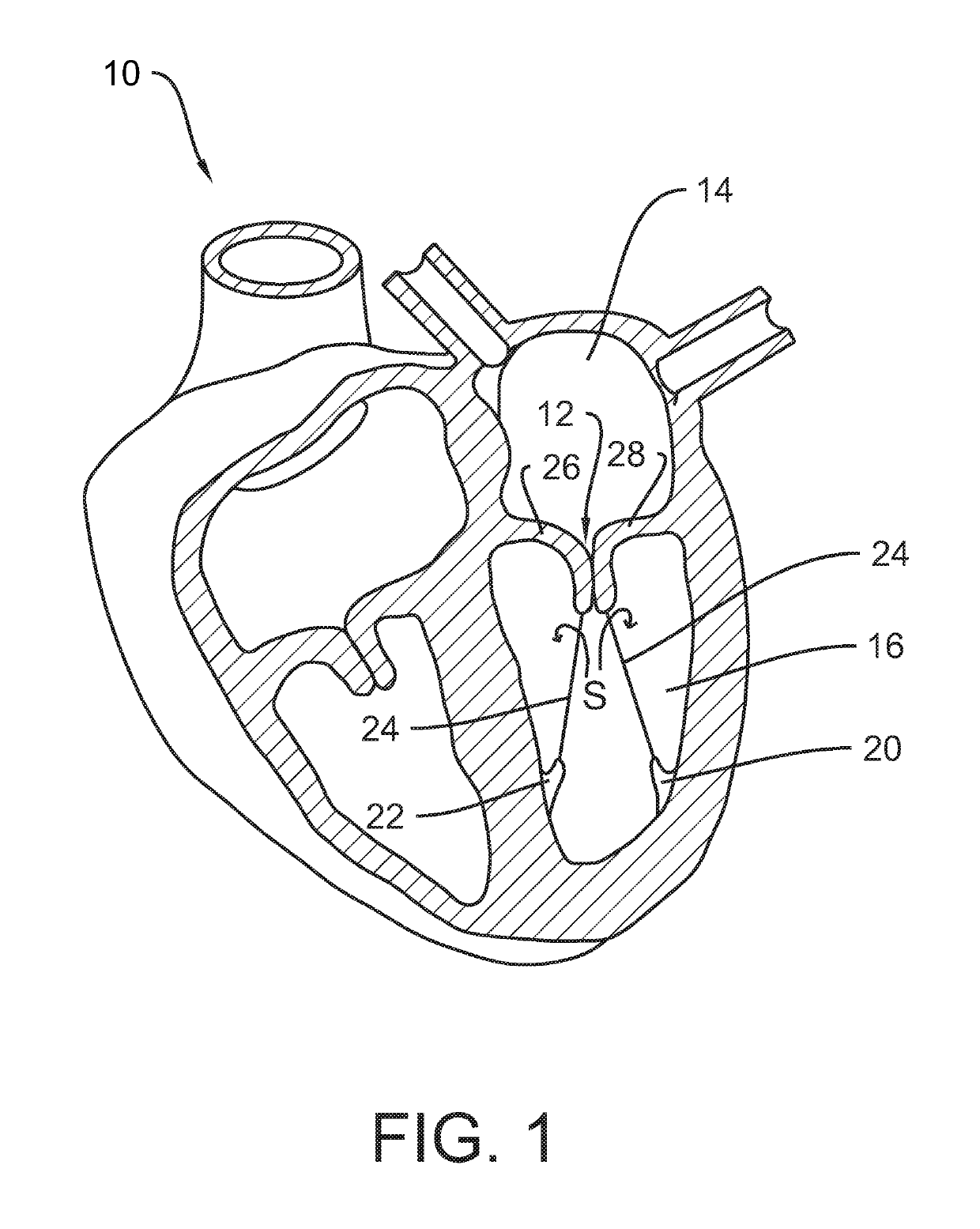 System and method for valve activation