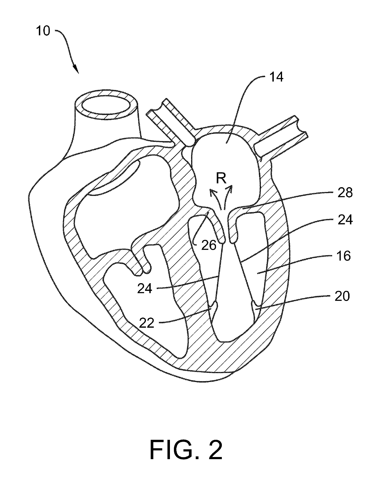 System and method for valve activation