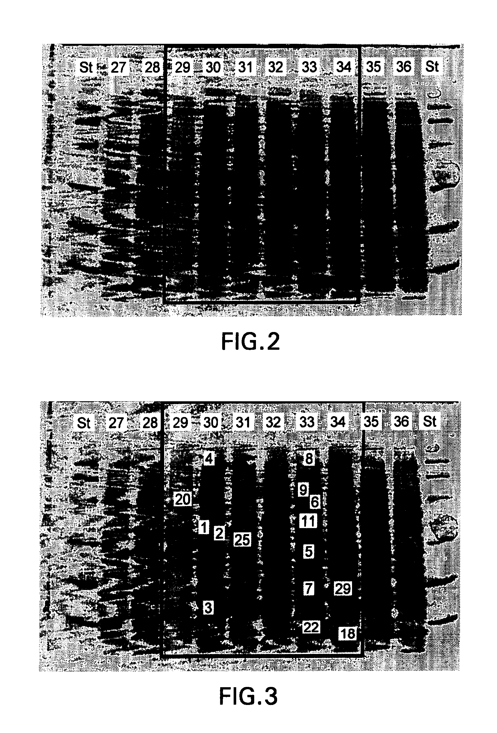 Method of promoting natural bypass