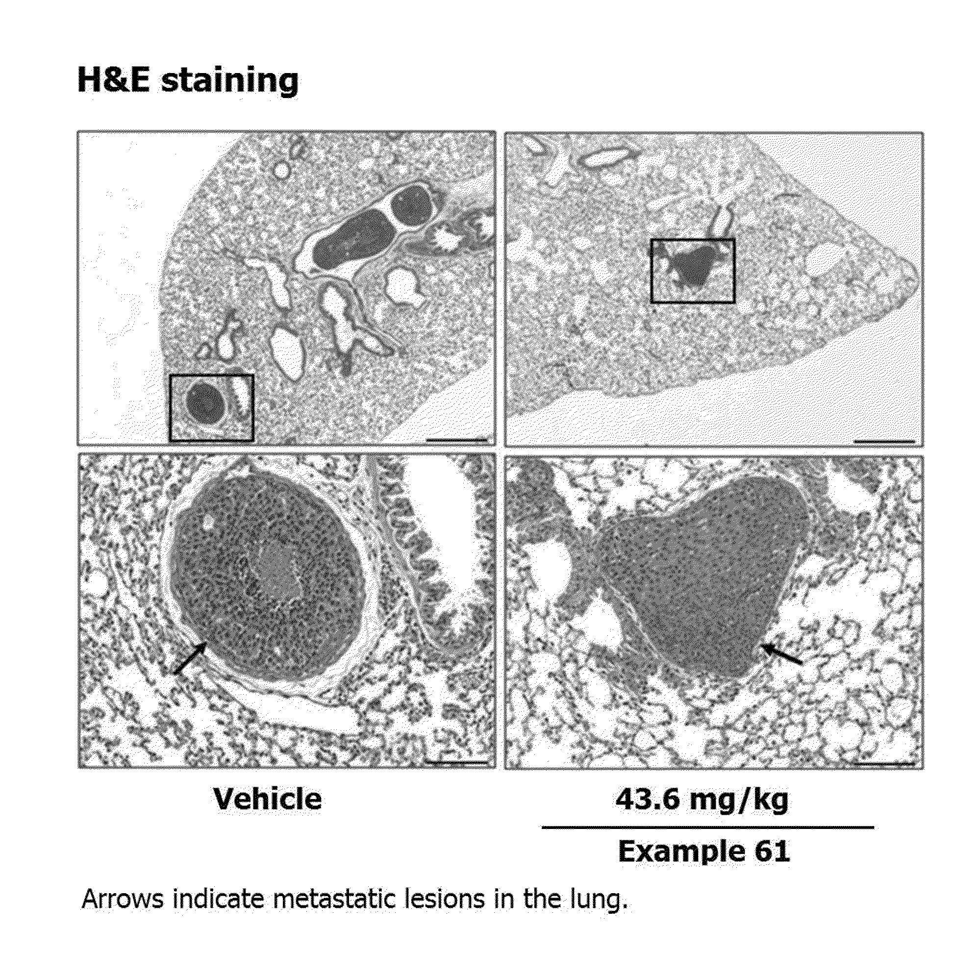 Methods of Treating Fibrosis, Cancer and Vascular Injuries