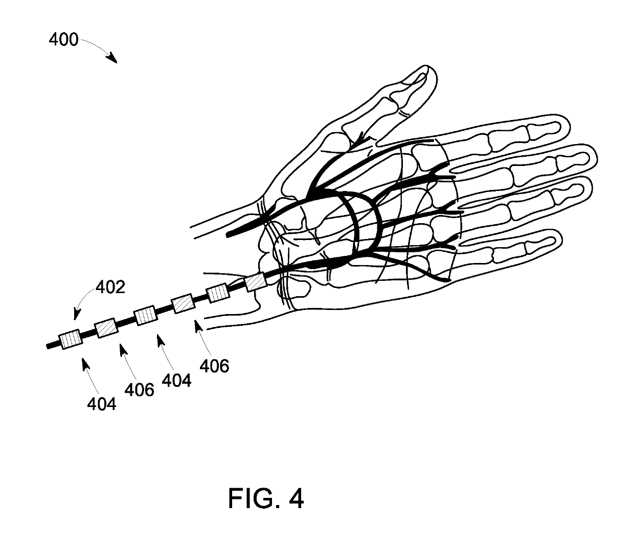 Systems and methods for improved physiological monitoring