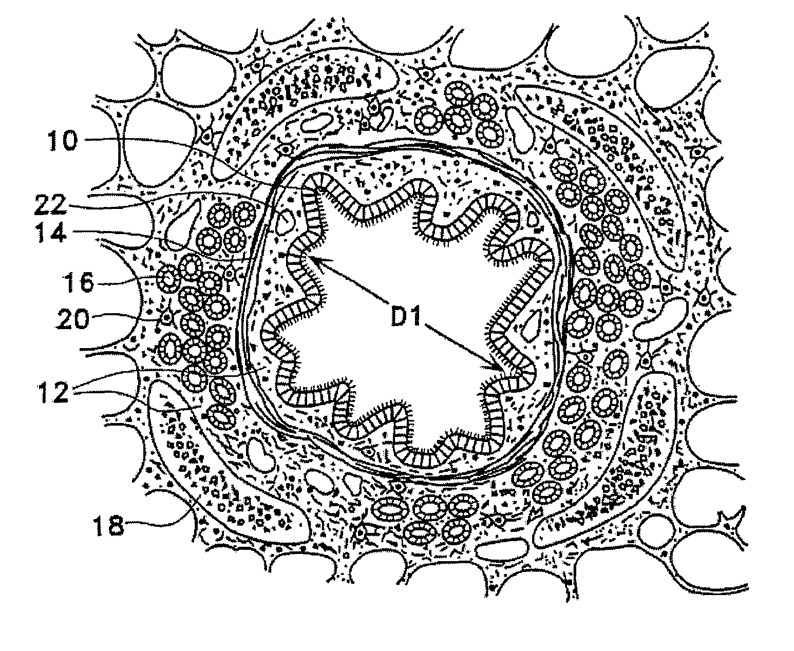 Methods of evaluating individuals having reversible obstructive pulmonary disease