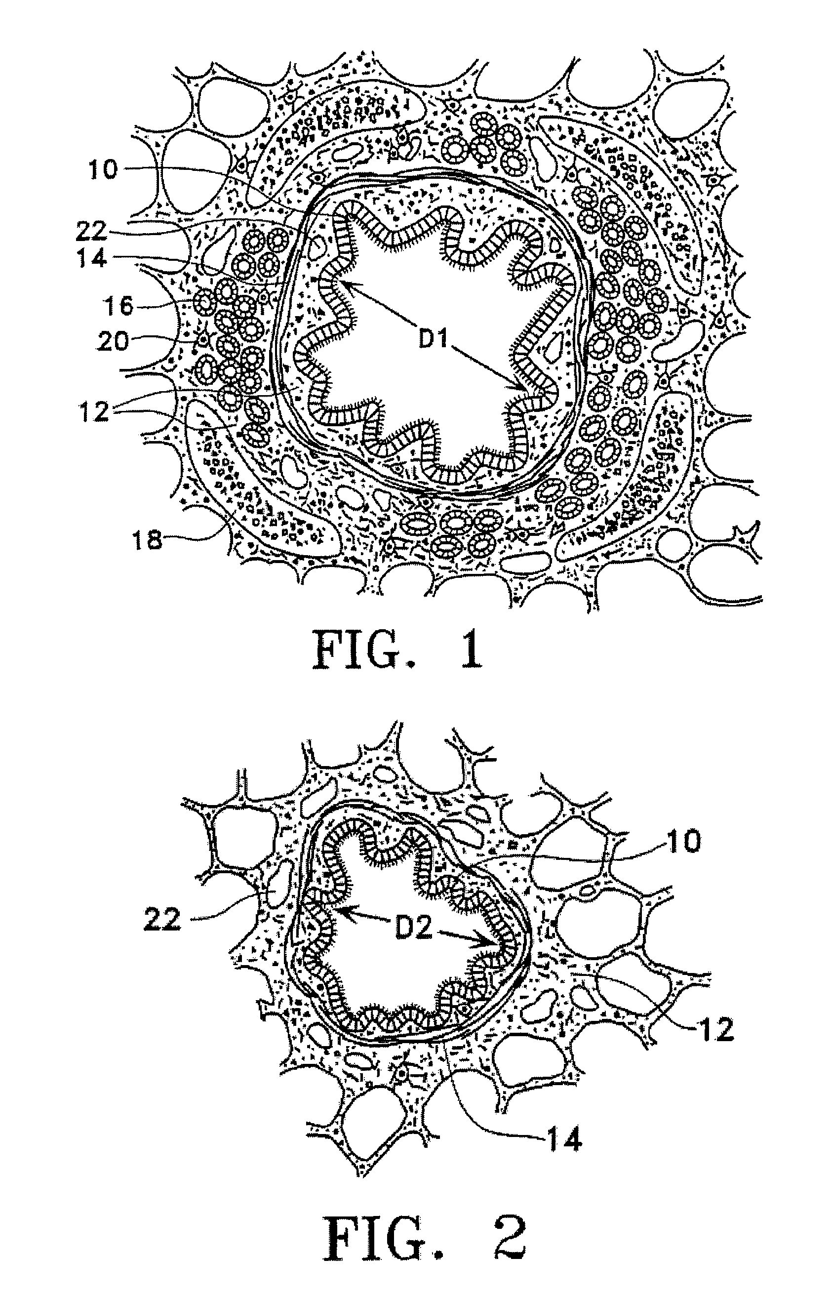 Methods of evaluating individuals having reversible obstructive pulmonary disease