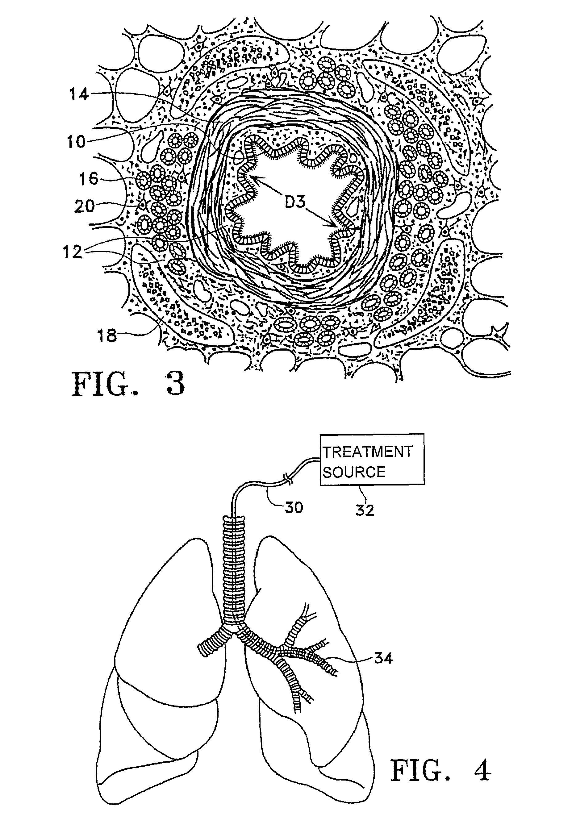 Methods of evaluating individuals having reversible obstructive pulmonary disease