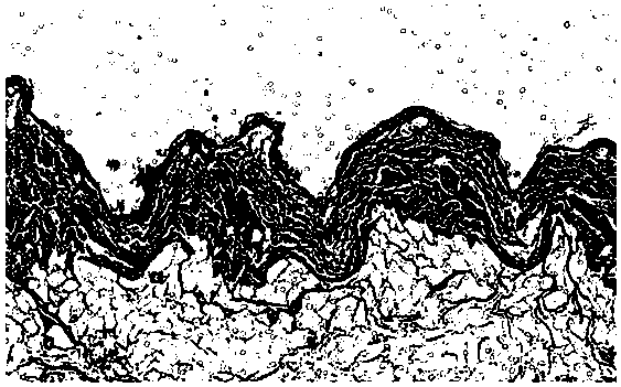 Dual-functional nanoparticle, soluble microneedle and preparing method and application of nanoparticle