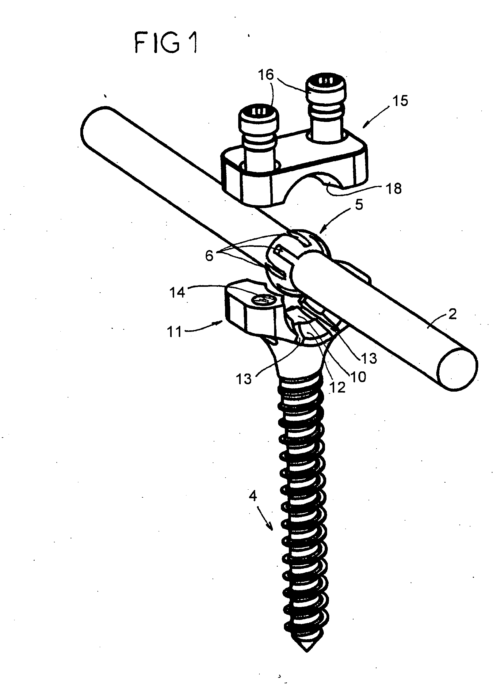 Vertebral arthrodesis device