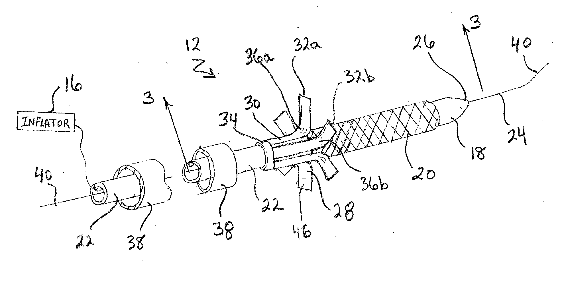 System and Method for Placing a Coronary Stent at the Ostium of a Blood Vessel