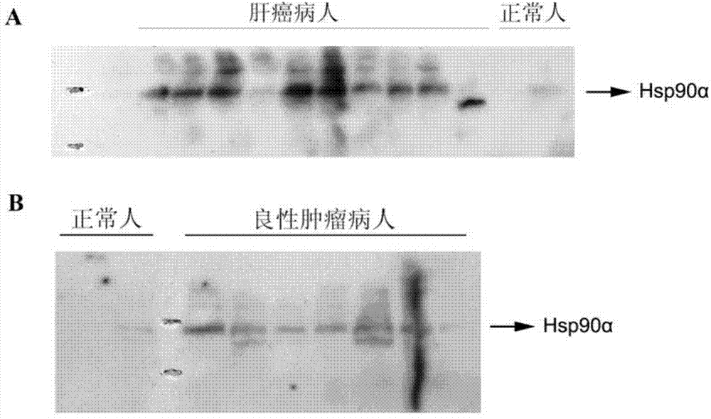 New tumor marker