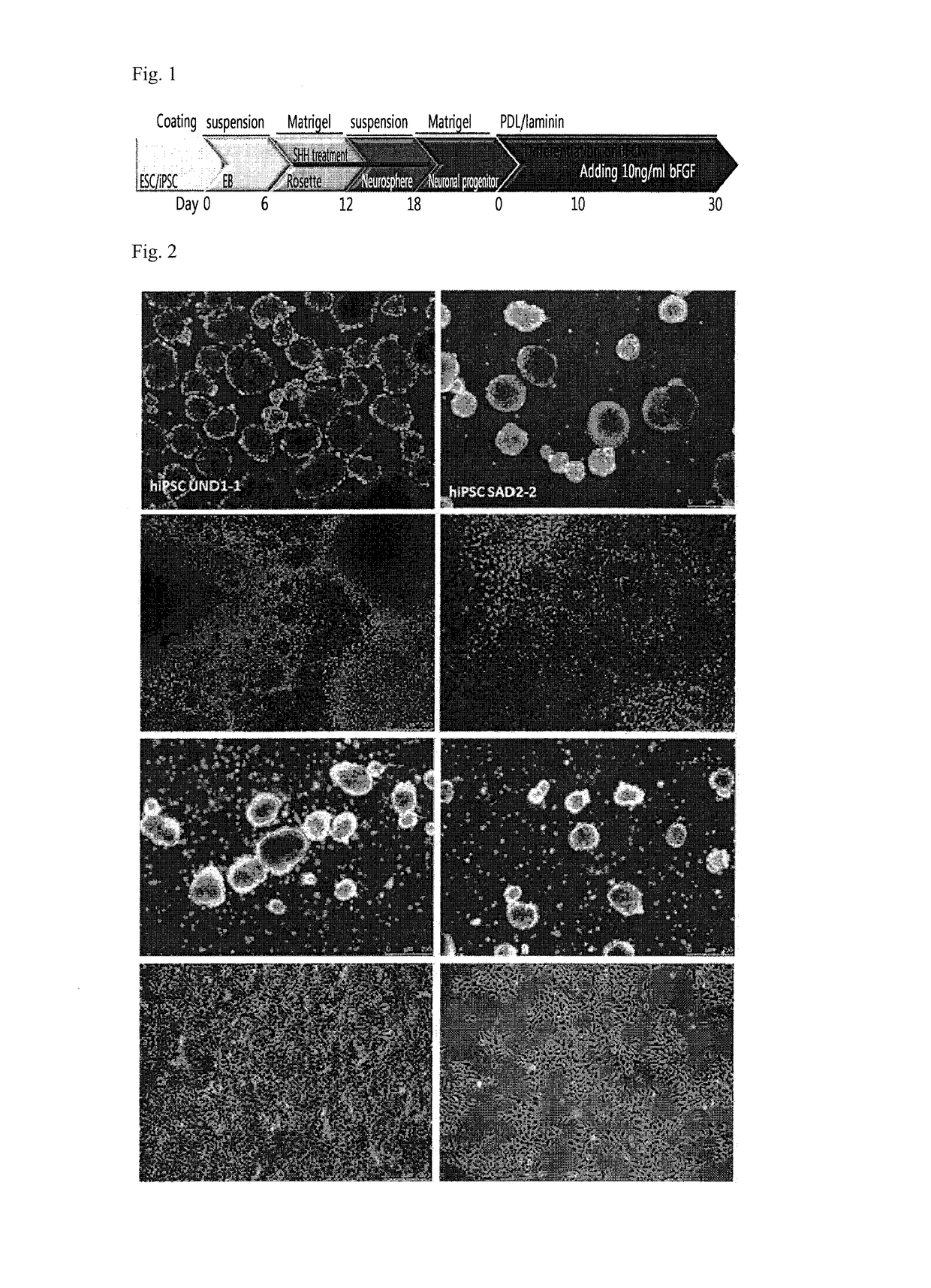 Process for preparing cholinergic neurons