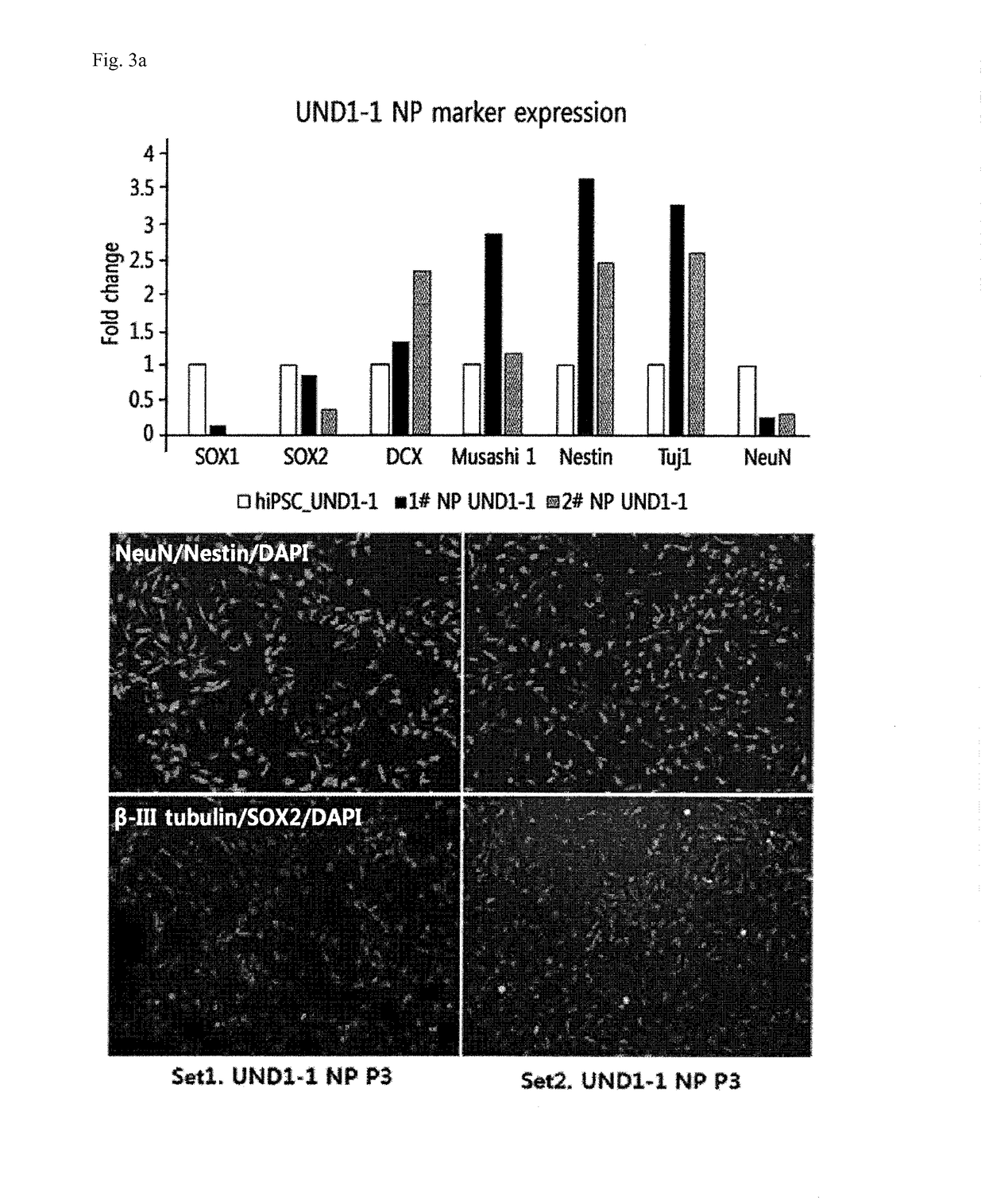 Process for preparing cholinergic neurons