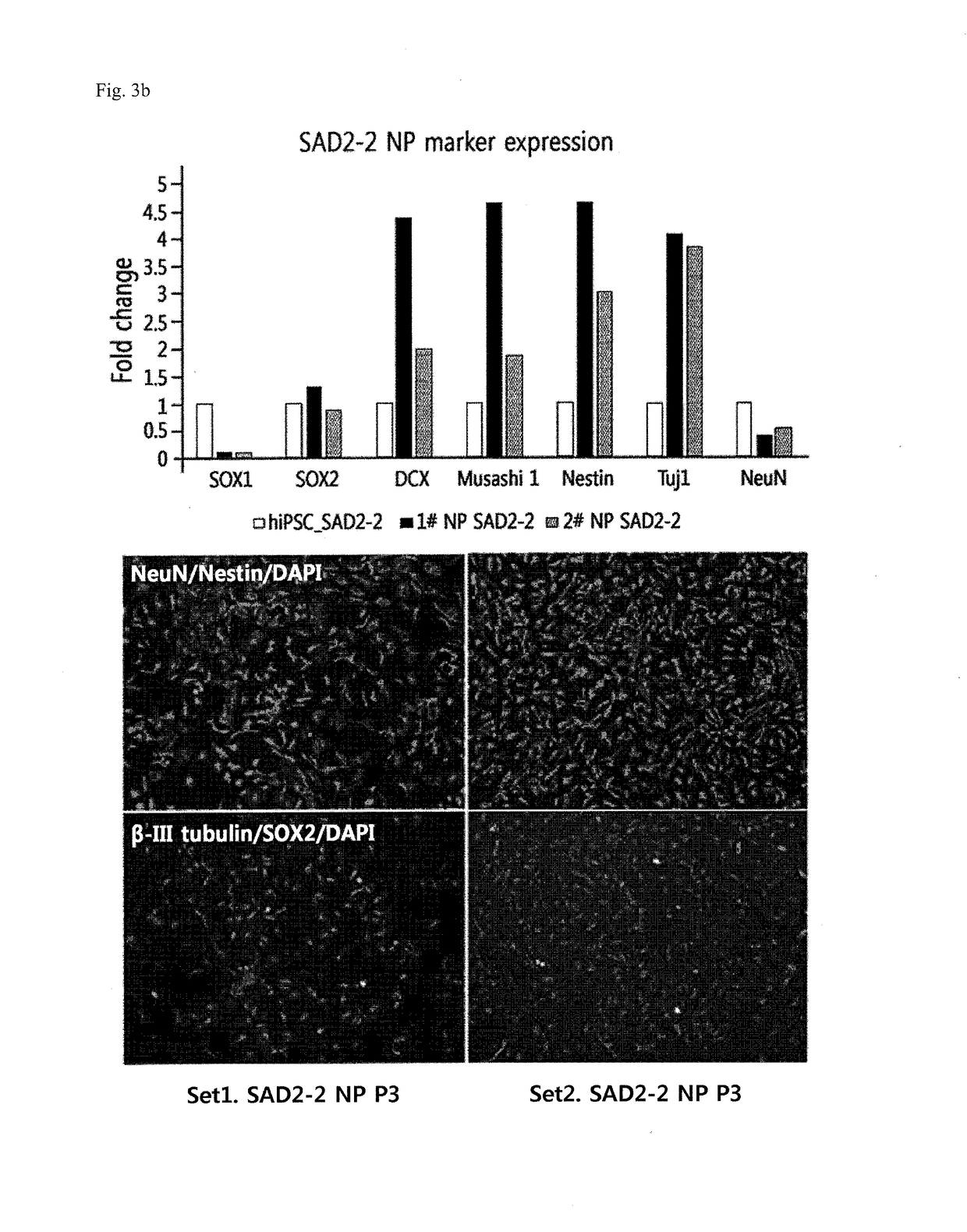 Process for preparing cholinergic neurons