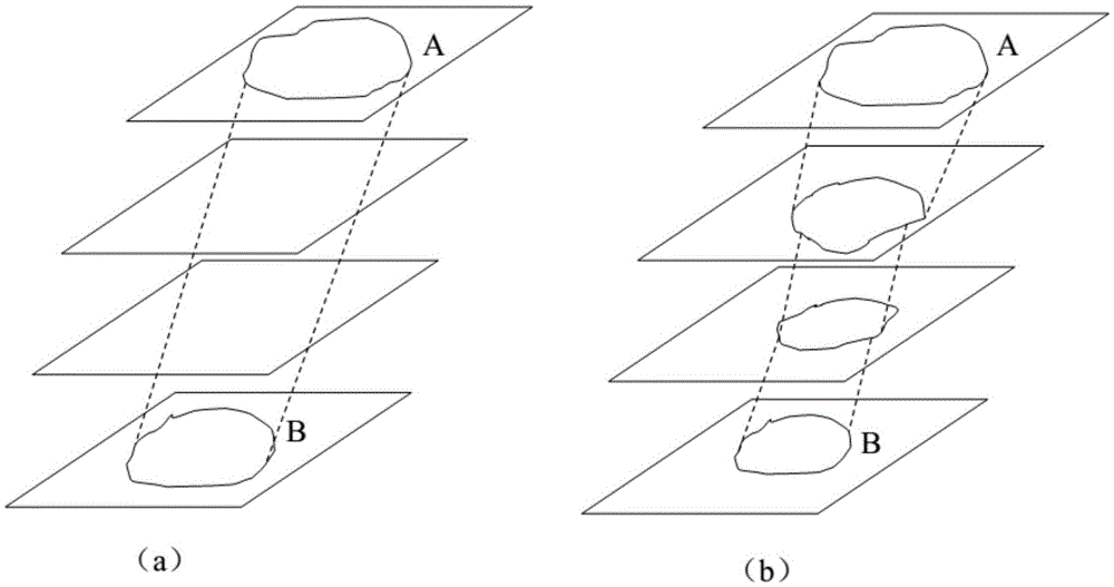 Brain ASL (Arterial Spin Labeling), SPECT (Single-Photon Emission Computed Tomography) and MRI (Magnetic Resonance Imaging) image registration and fusion conjoint analysis method and system