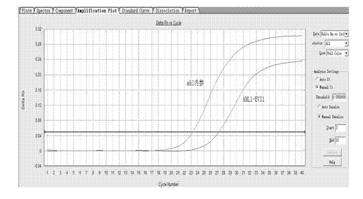 Kit for detecting relevant expression quantity of AML-EVI1 (acute myelocytic leukemia-ecotropic virus integration site 1) fusion gene