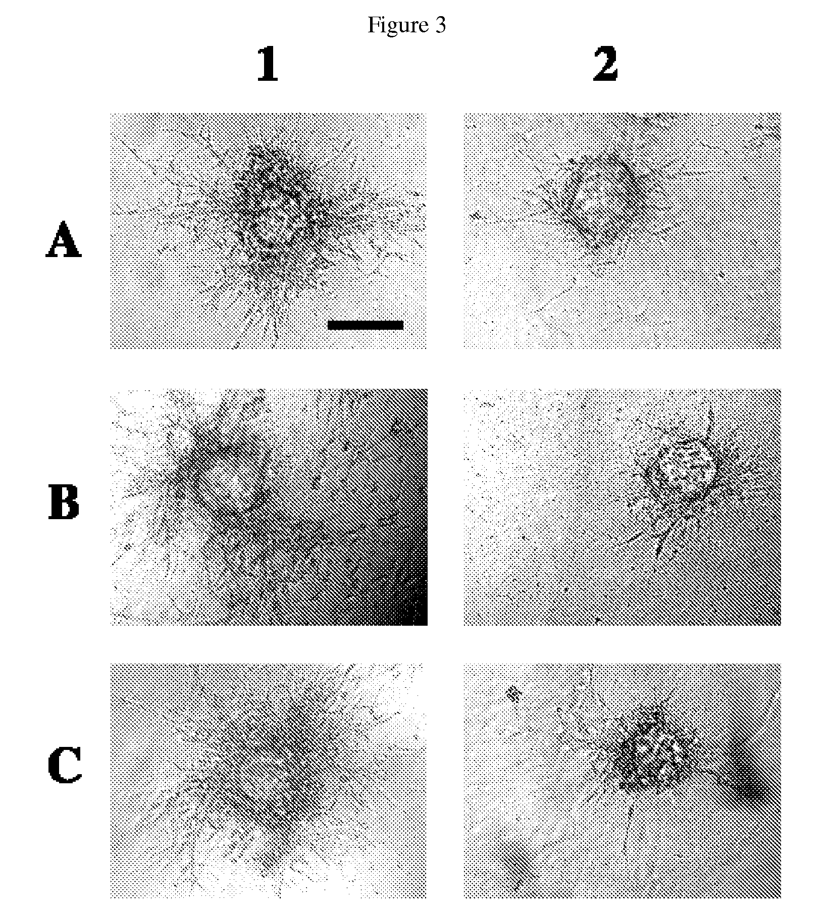 Use of lipid conjugates in the treatment of diseases associated with vasculature