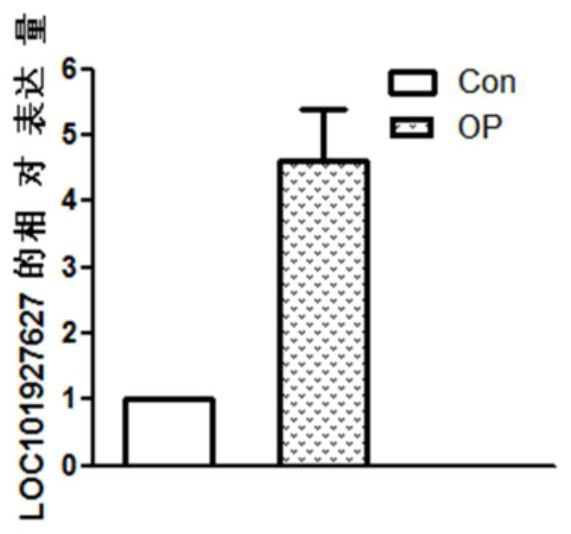 Biomarkers for Osteoporosis Diagnosis and Treatment