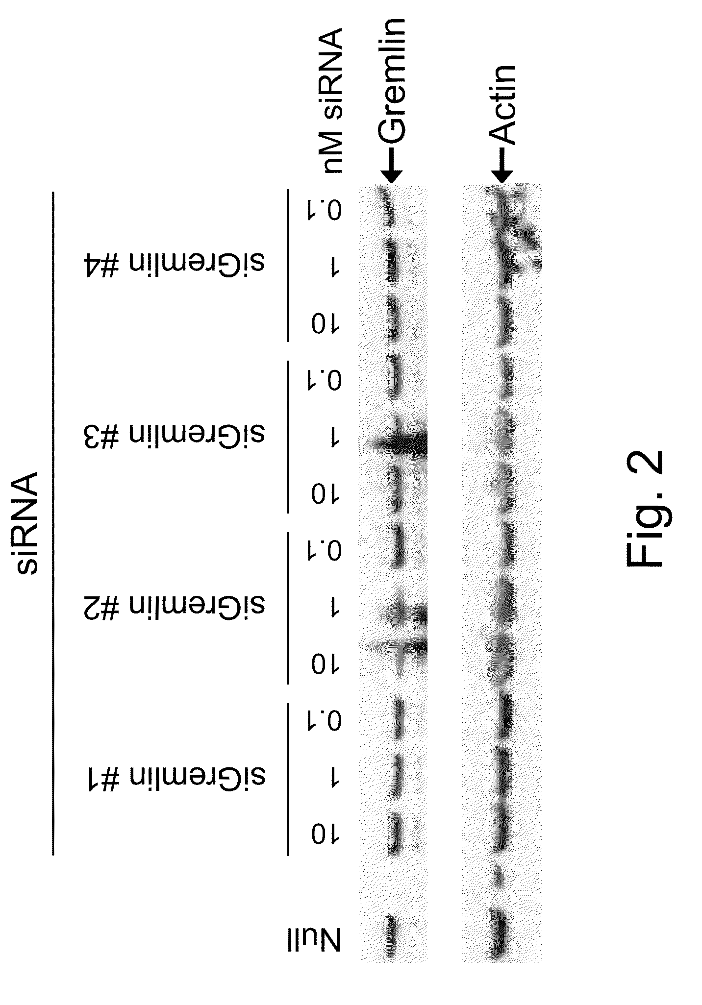 Rnai-mediated inhibition of gremlin for treatment of iop-related conditions