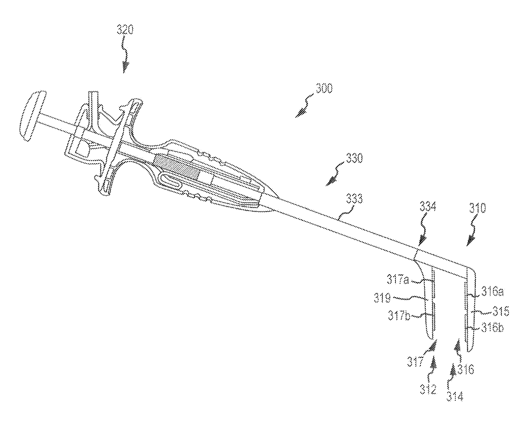 High-voltage pulse ablation systems and methods