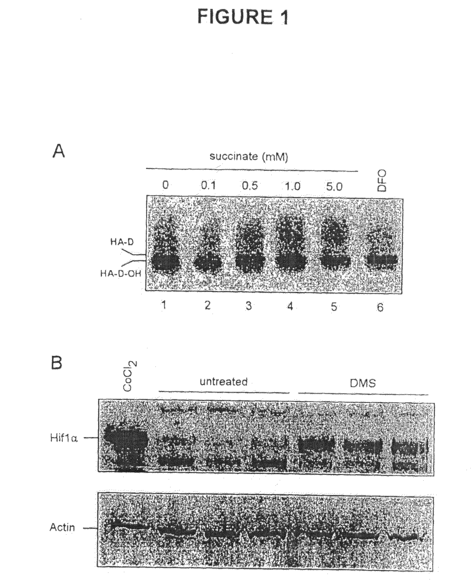 Alpha-Ketoglutarates and Their Use as Therapeutic Agents