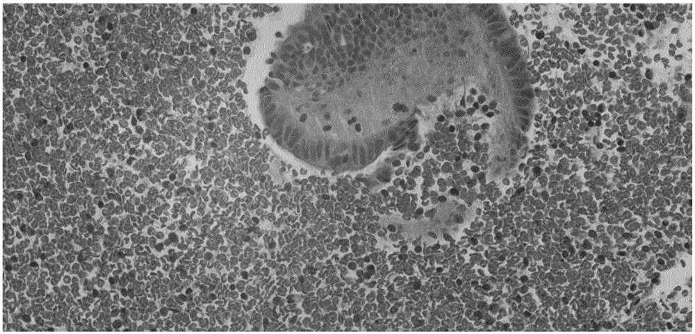 Medical image enhancement method based on human eye visual characteristic