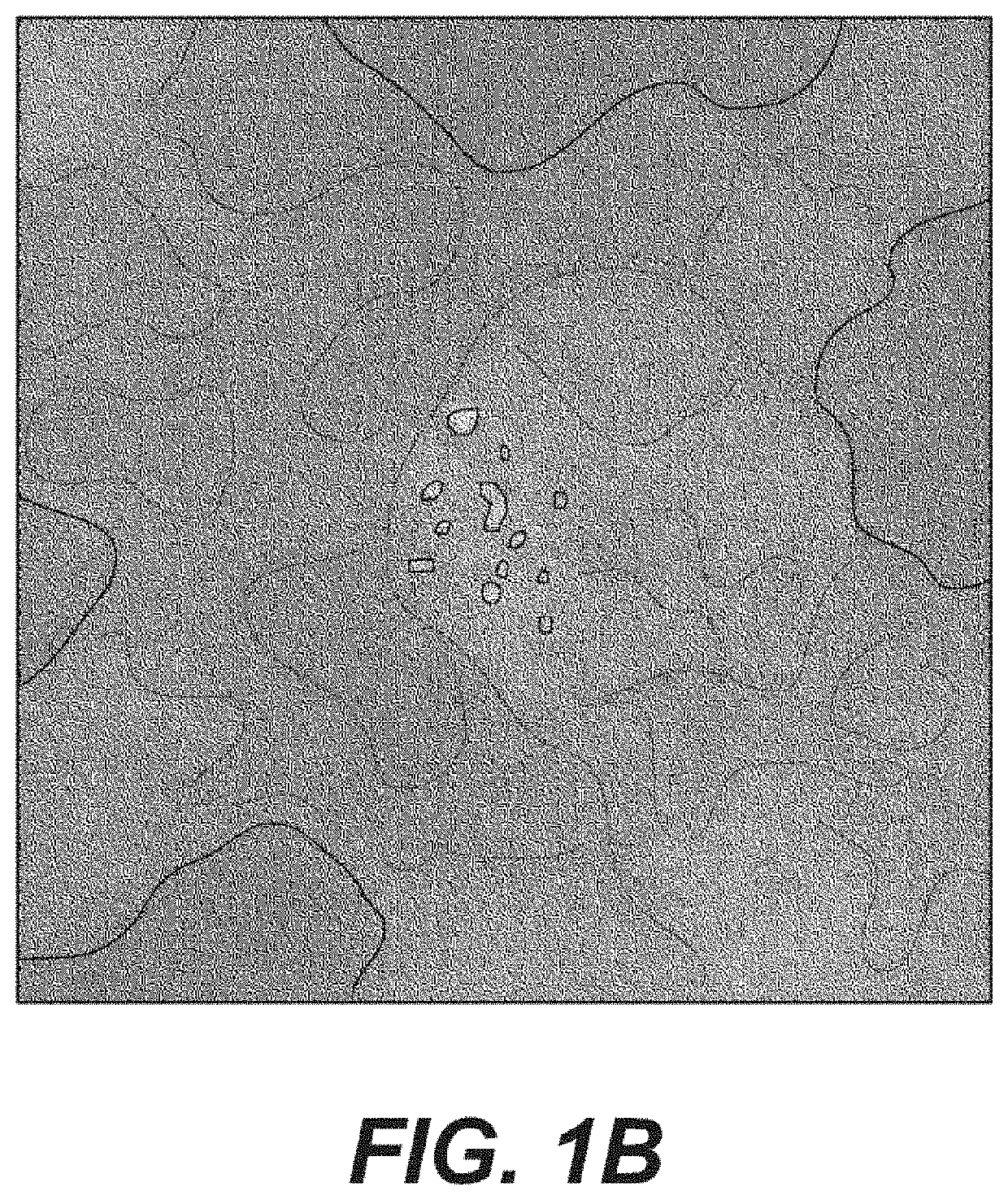 System, method and computer-accessible medium for a patient selection for a ductal carcinoma in situ observation and determinations of actions based on the same