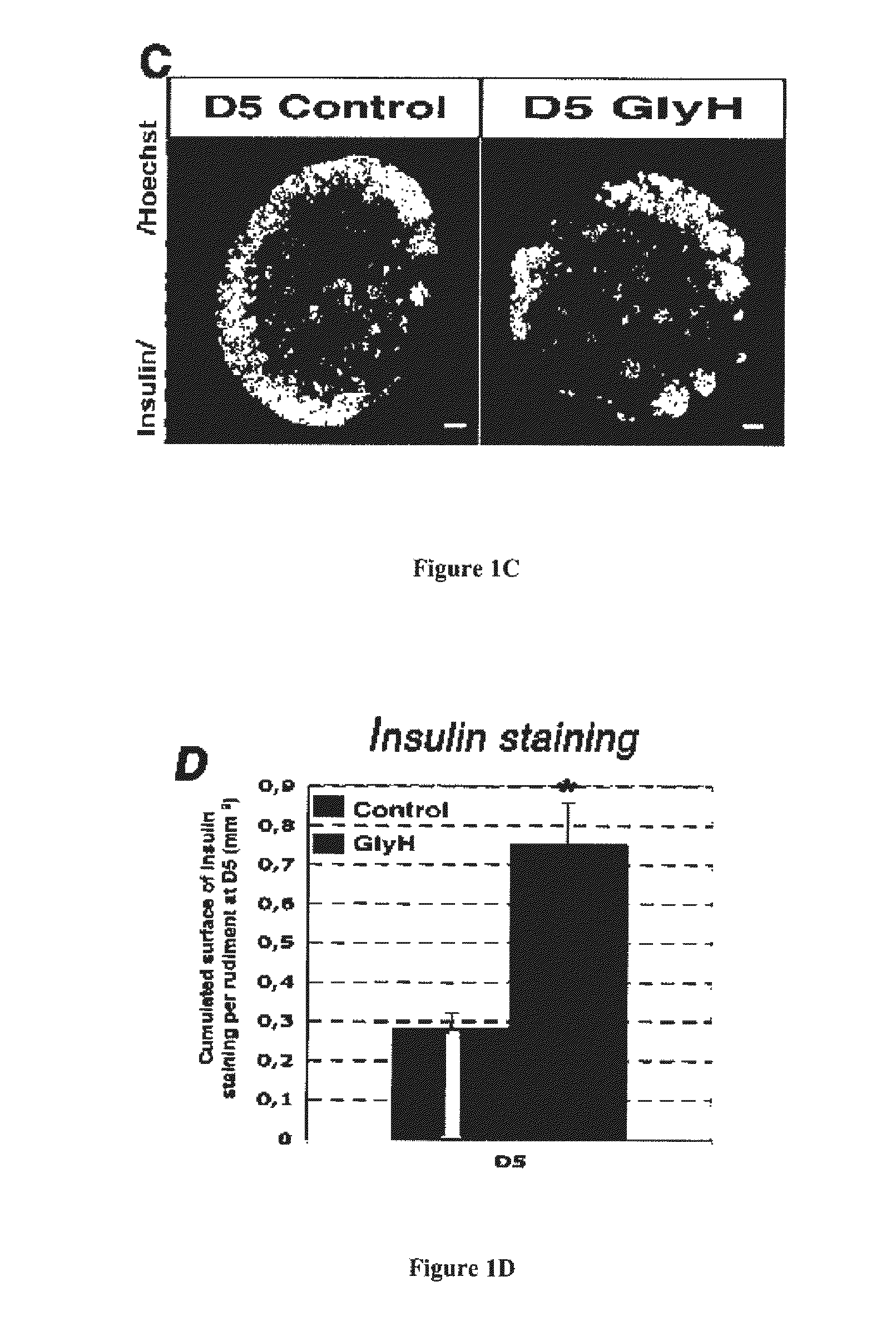 Methods and pharmaceutical compositions for the treatment of disorders of glucose homeostasis