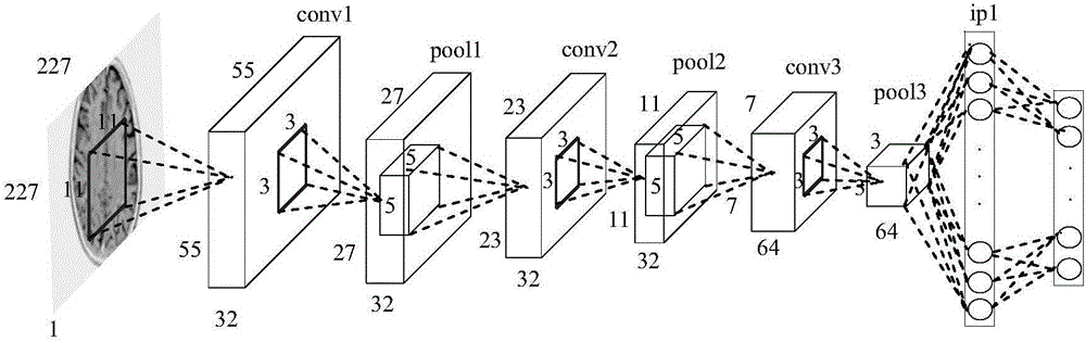 Deep hash-based medical image distributed retrieval method