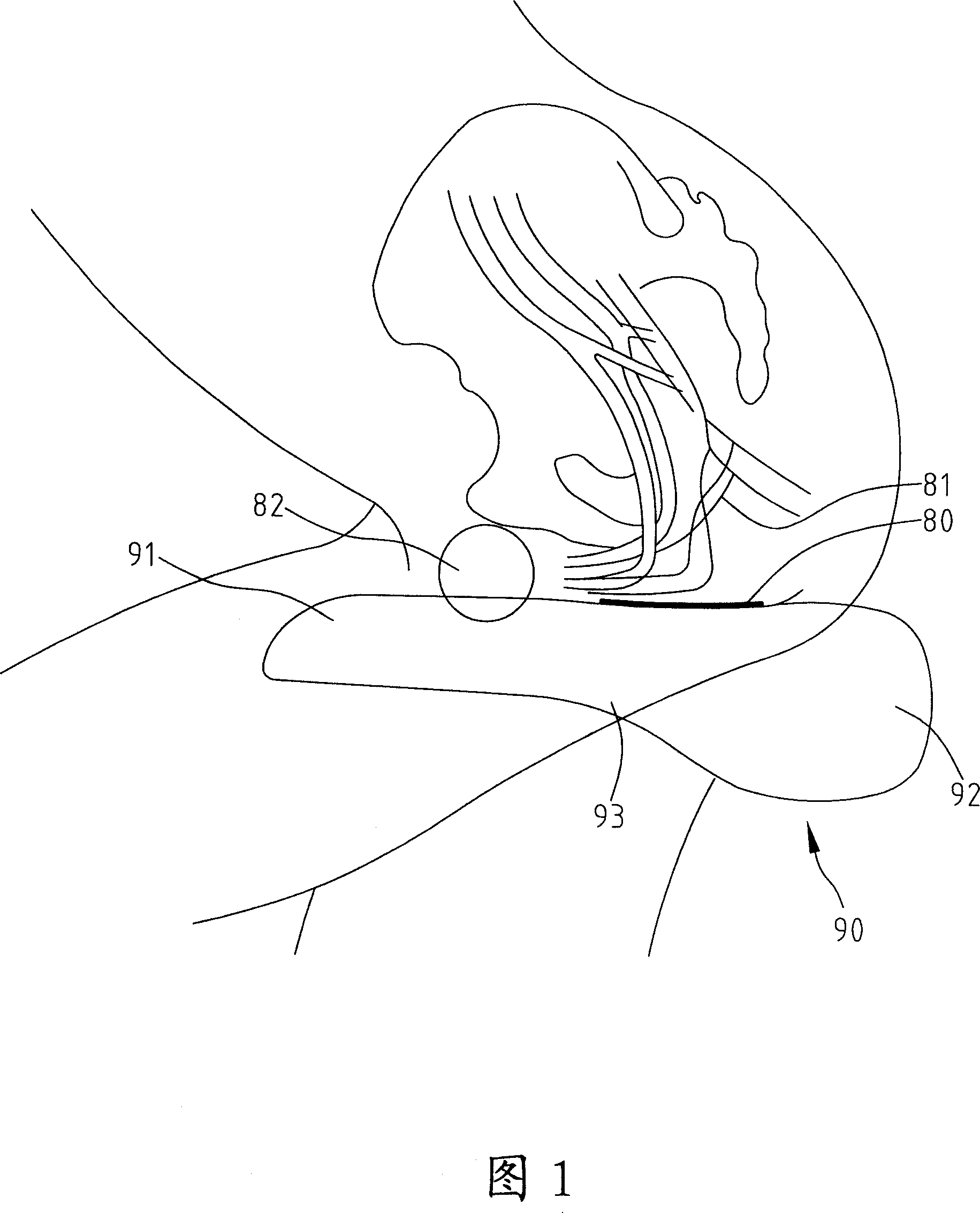 Bicycle saddle cushion