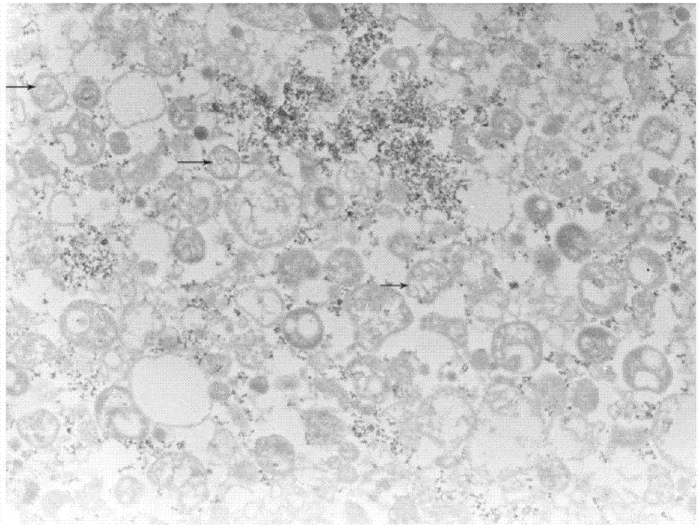 B cell vaccine based on Hepal-6 hepatoma cell autophagosome-DRibbles and preparation method of B cell vaccine