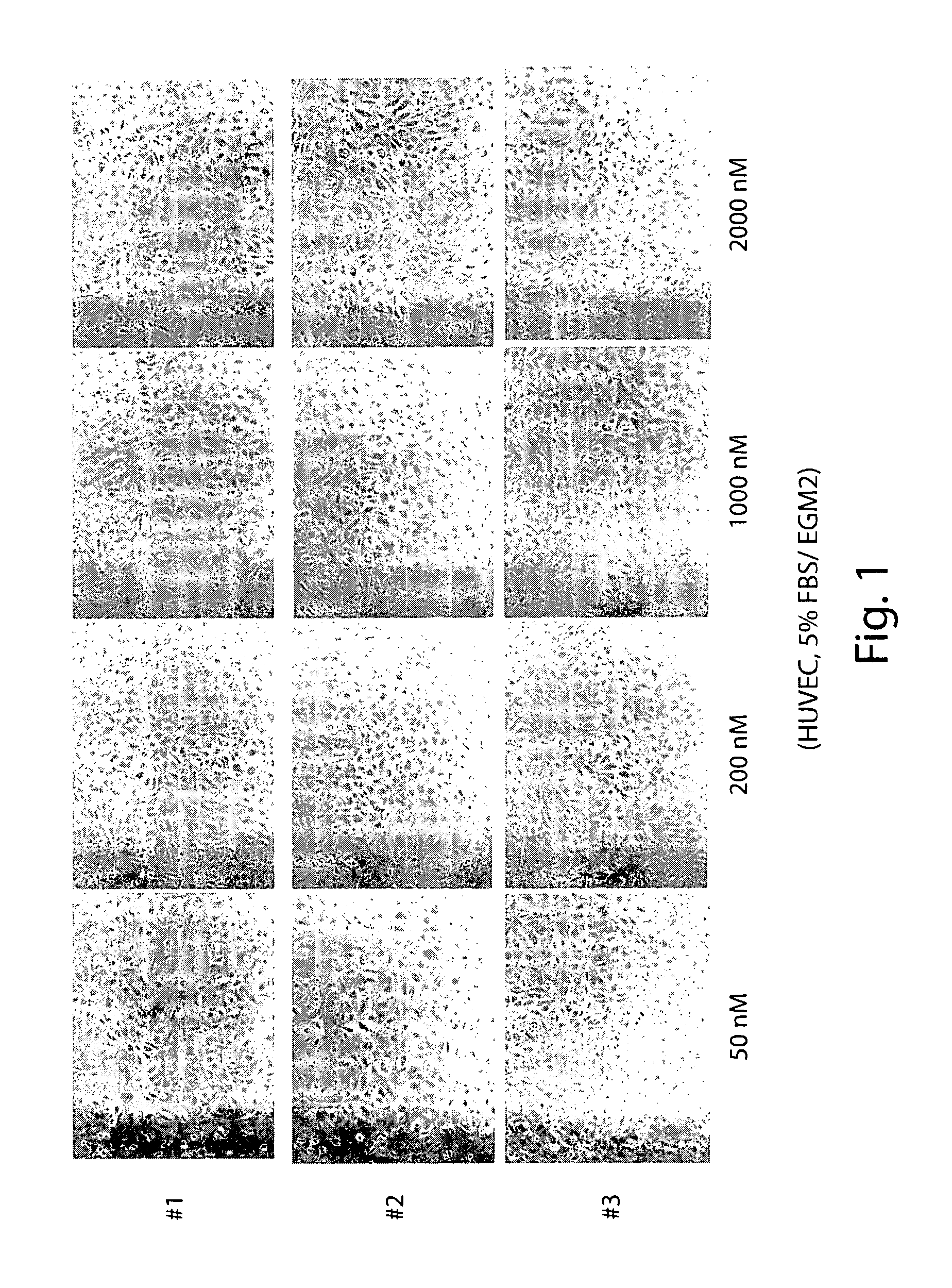 Angiogenesis inhibitors