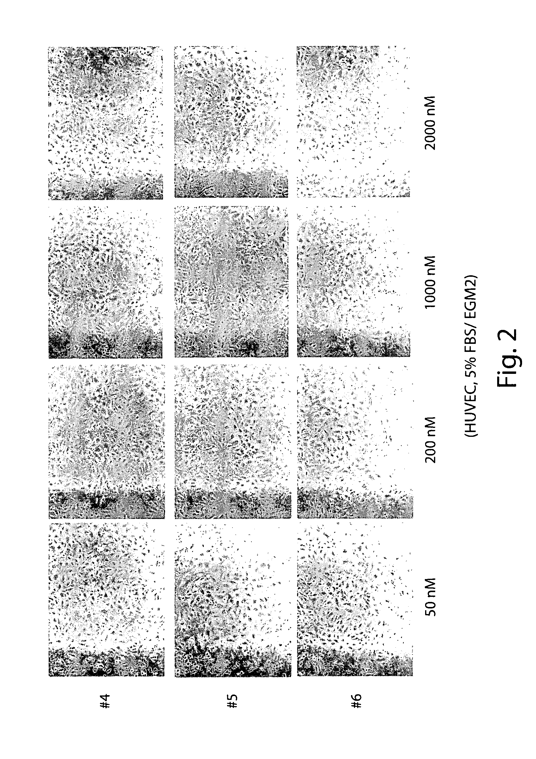 Angiogenesis inhibitors