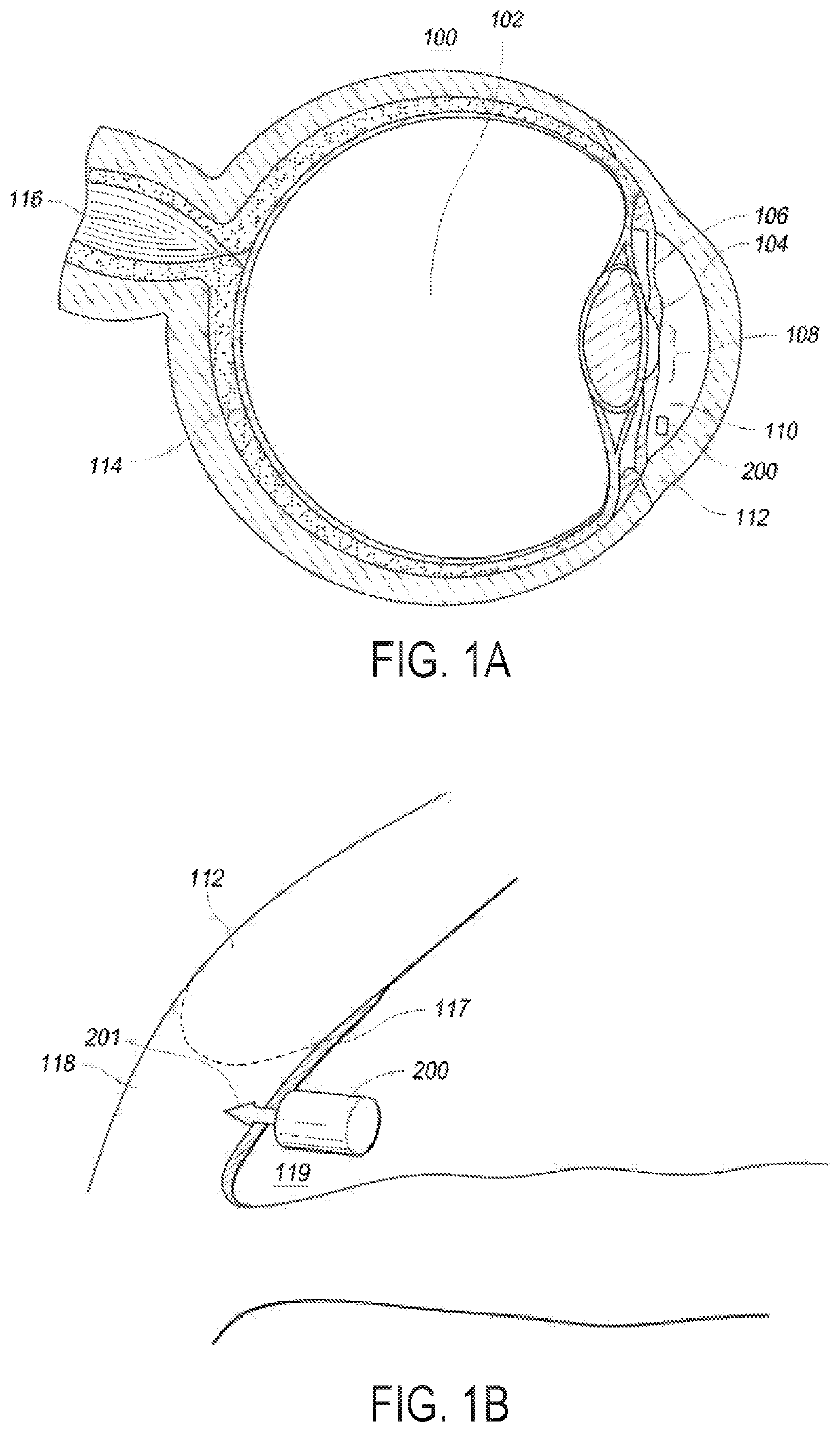 Intraocular physiological sensor