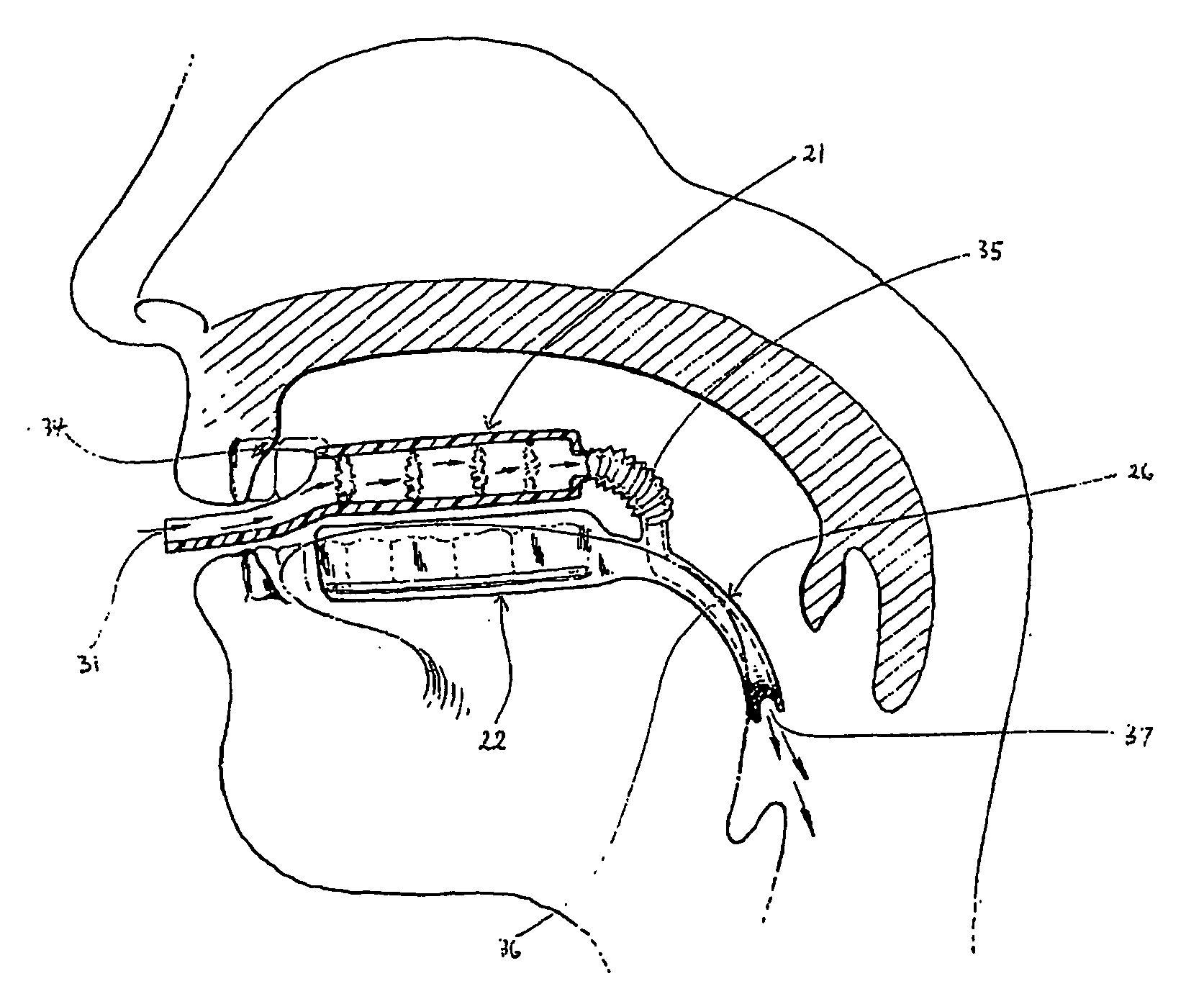 Oral Cavity Manipulator