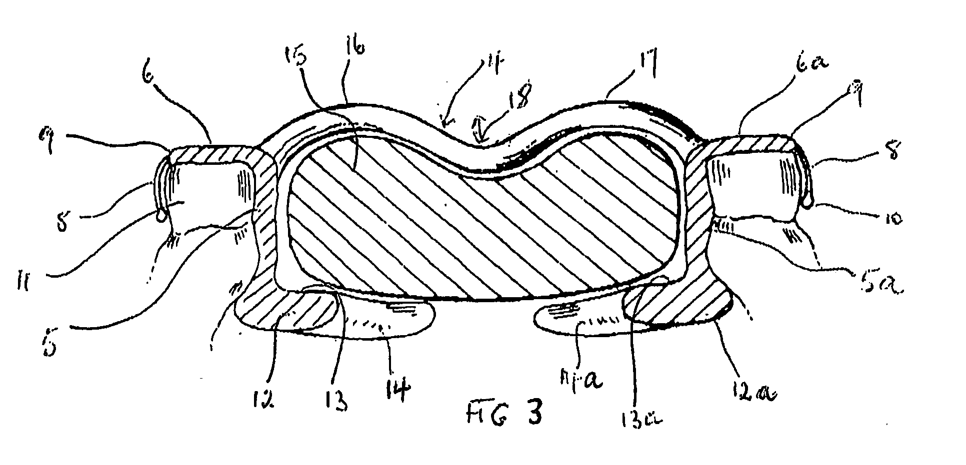 Oral Cavity Manipulator