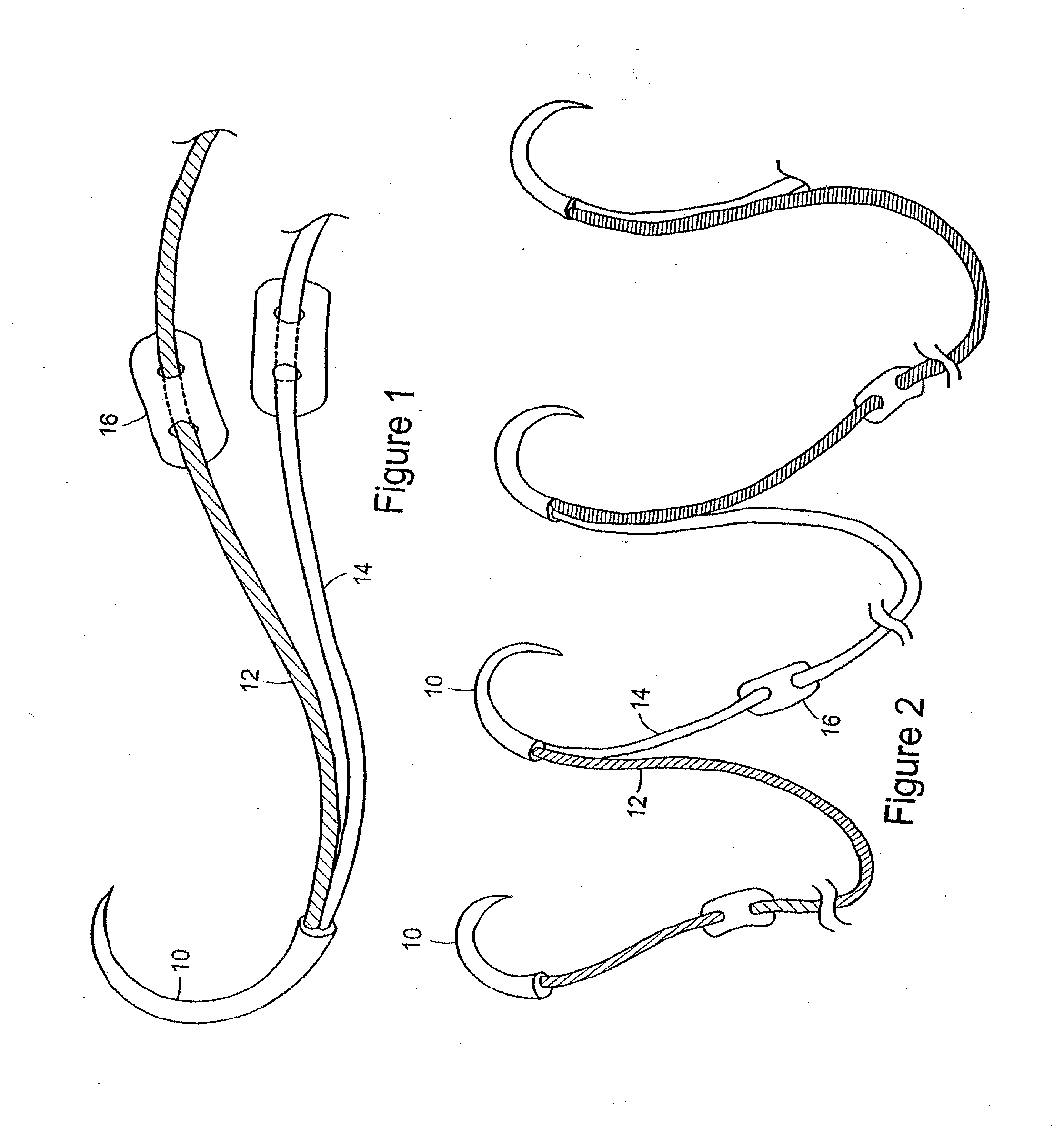 Suture system