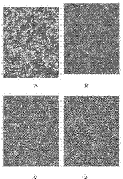 Acquisition method of adipose-derived stem cells