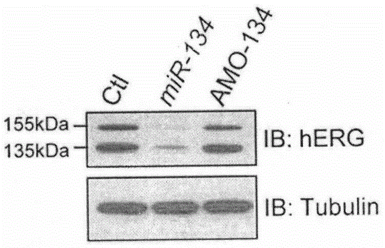 Application of AMO-134 in preparation of medicine for treating arrhythmia