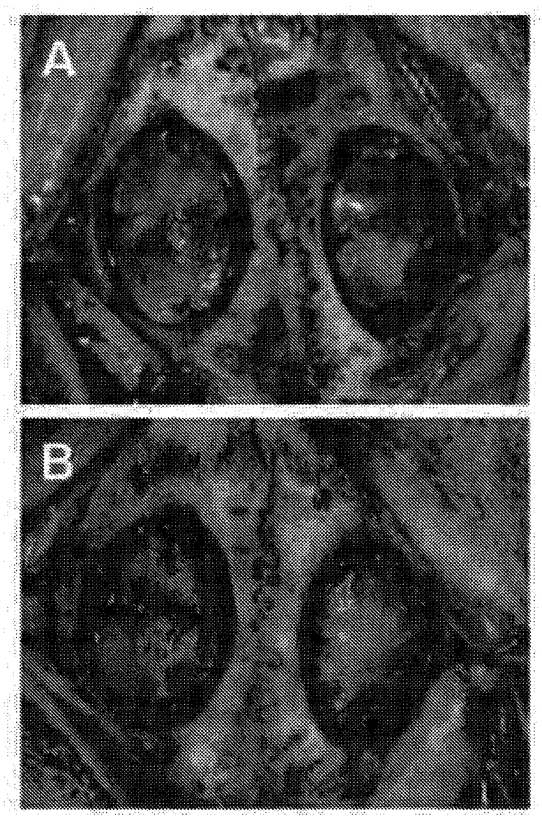 Tissue substitute materials and methods for tissue repair